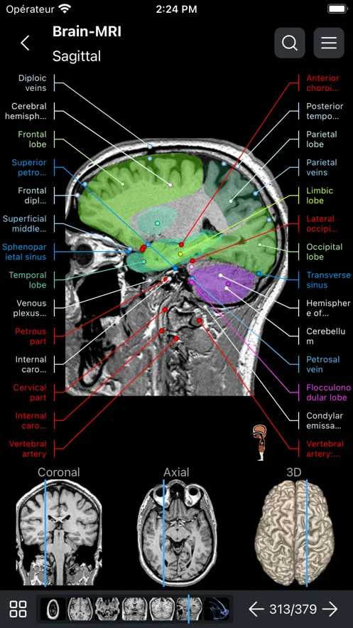 e-Anatomyv4.11.0 ��Ѱ��ͼ