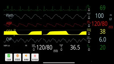 ģ��໤�����������ֻ���v1.0.2 ��׿���ͼ